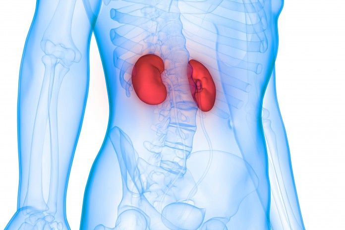 ABO Incompatible kidney Transplant