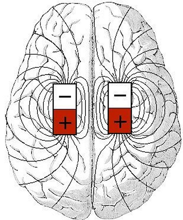 Мозг магнитное поле